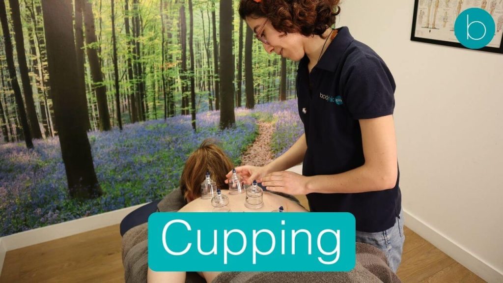 cupping therapy