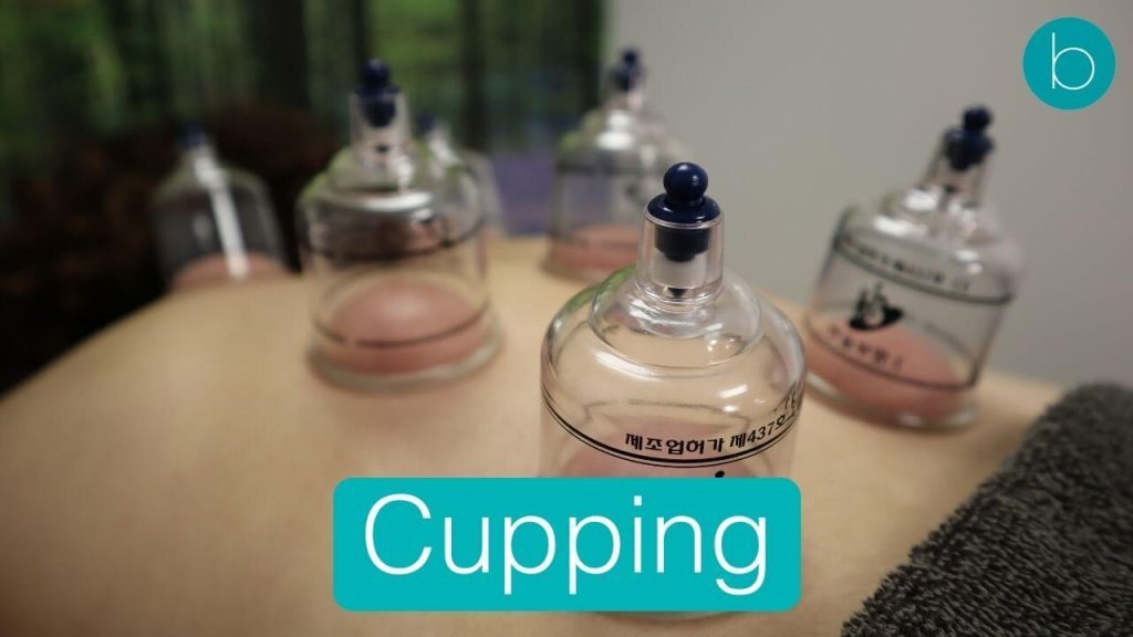 Best Massage-Cupping-London-bodytonic-clinic-E15-SE16