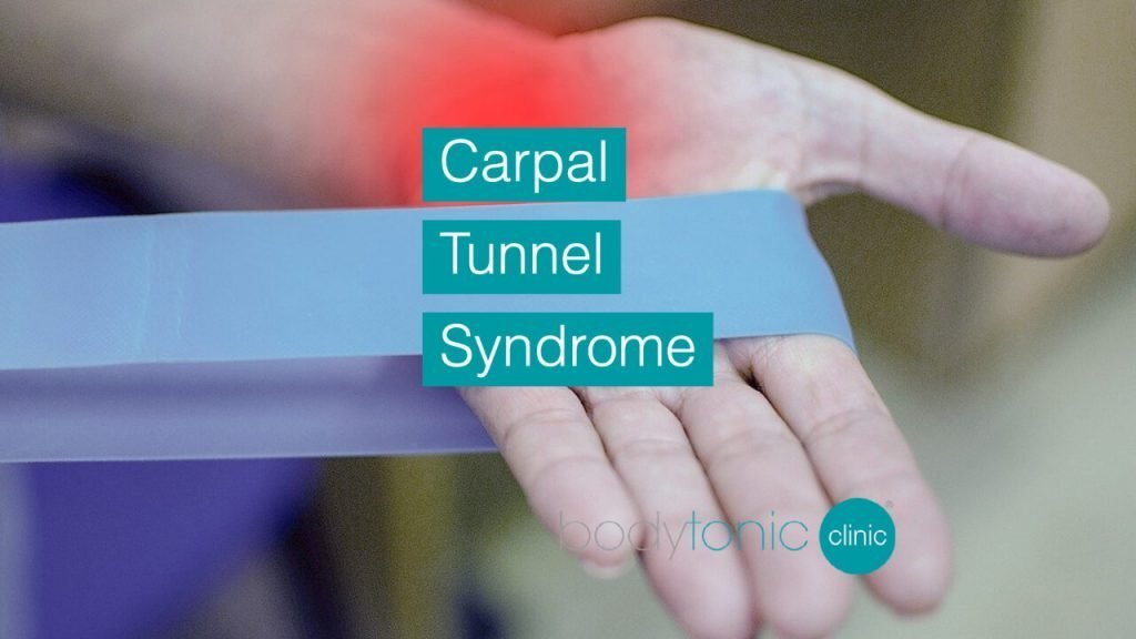 Carpal Tunnel Syndrome bodytonic clinic London
