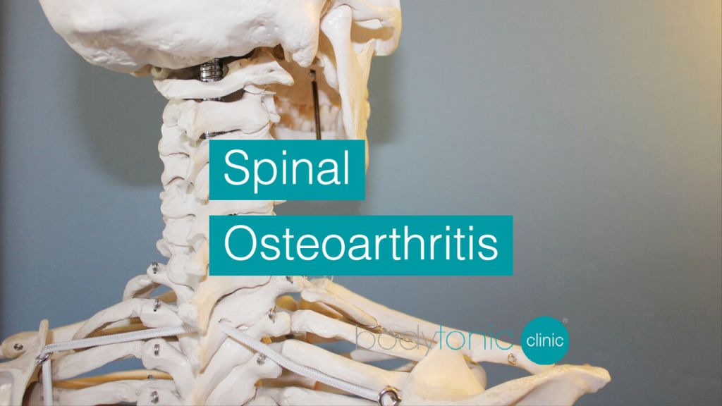 Spinal Osteoarthritis bodytonic clinic SE16