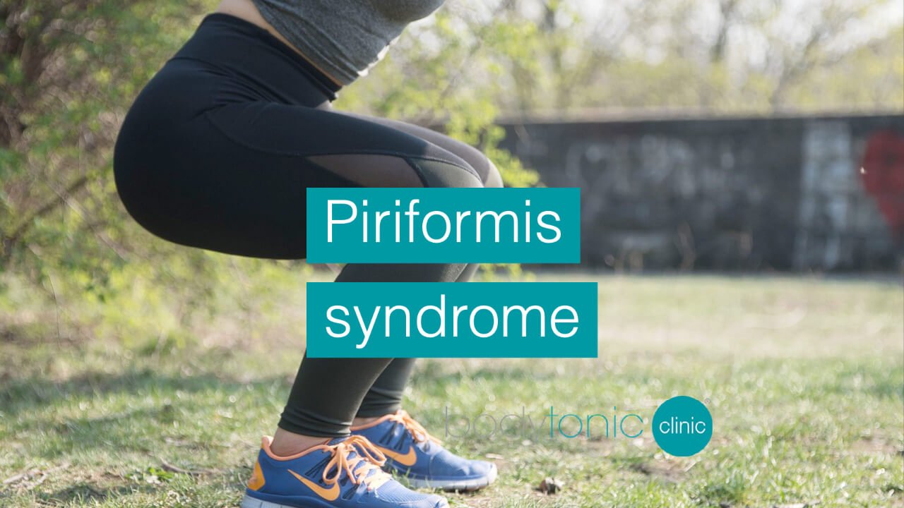 Piriformis syndrome bodytonic clinic SE16 London