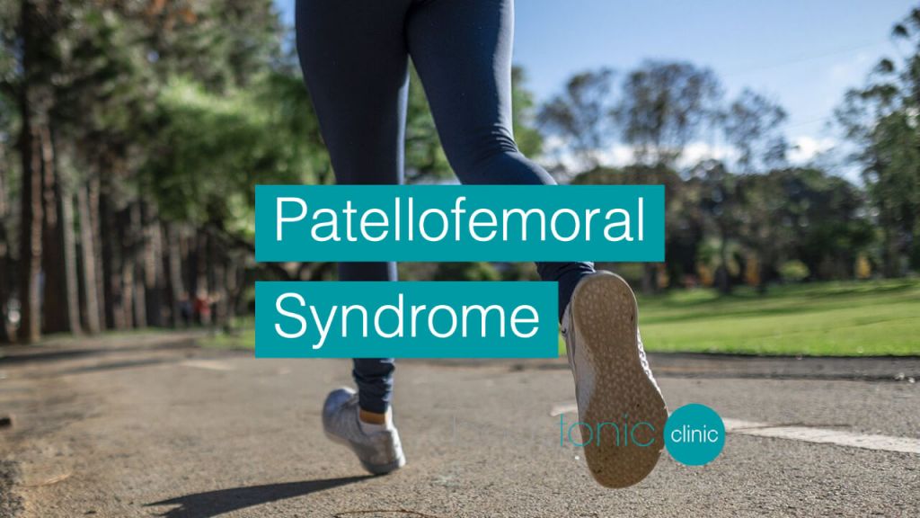 Patellofemoral Syndrome bodytonic clinic SE16