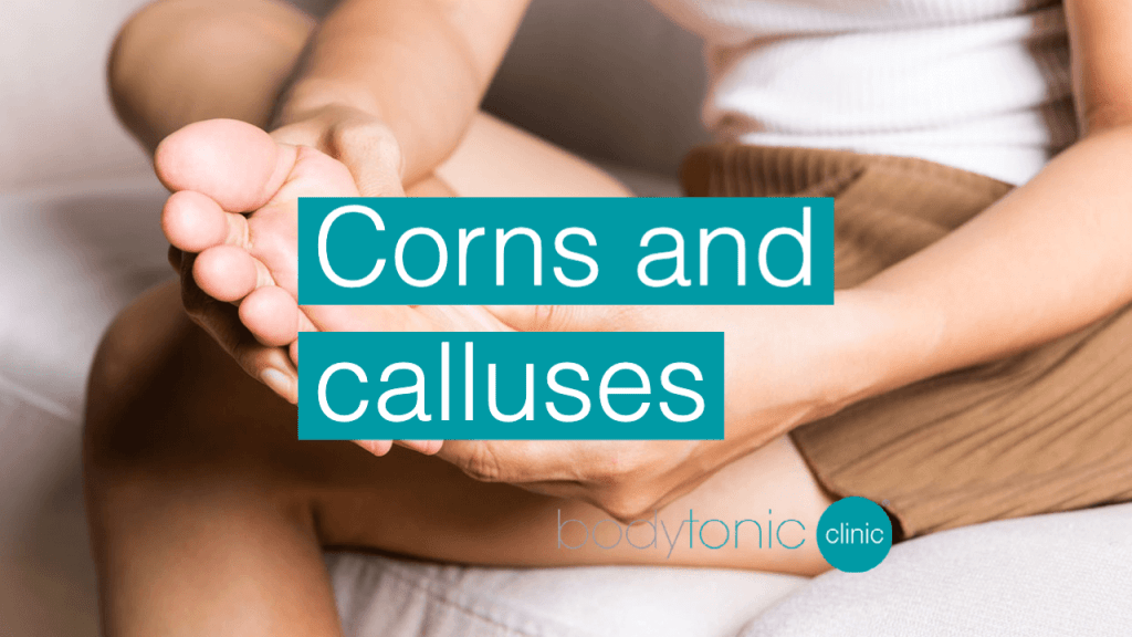 Corns and calluses bodytonic clinic SE16 London