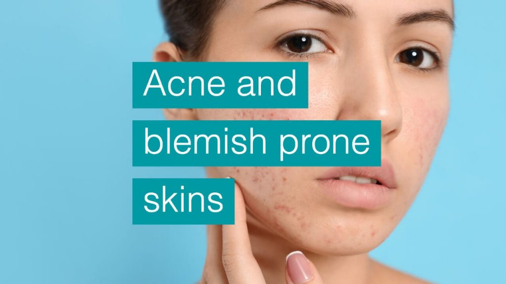 Acne and blemish prone skins SE16 London Canada Water Facial Treatment bodytonic clinic Stratford E15, near Canary Wharf E14