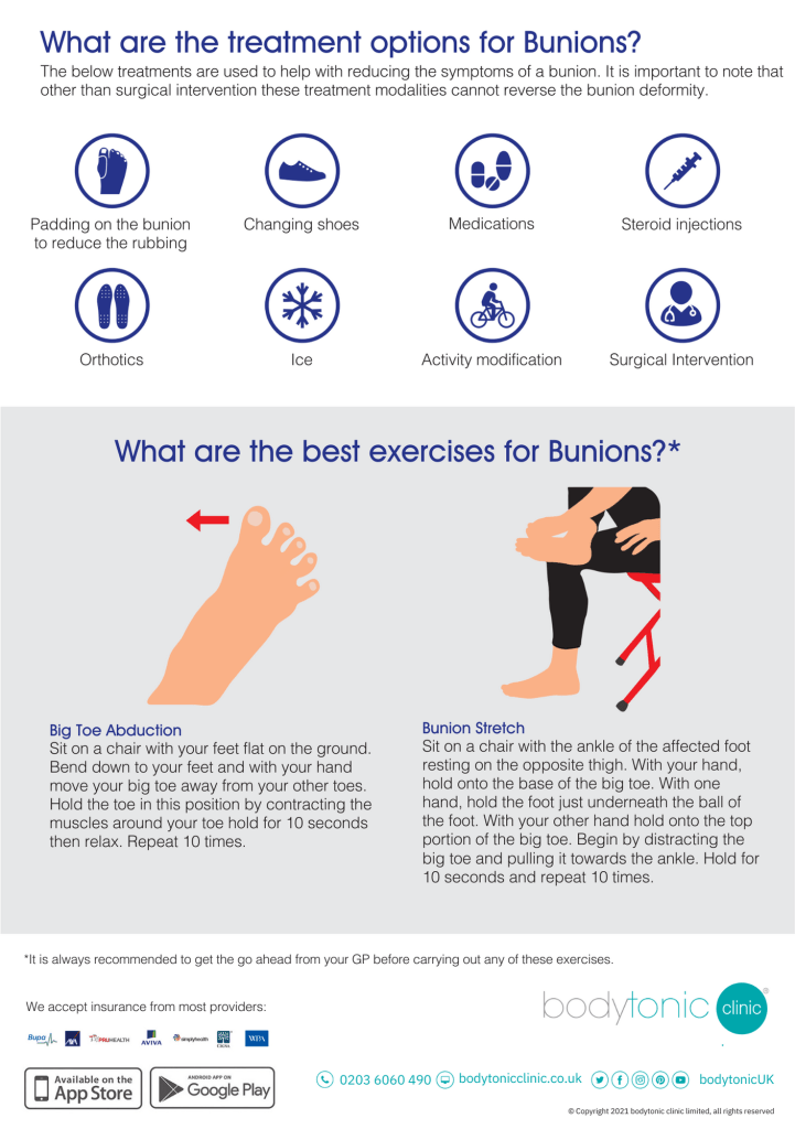 Bunions The Ultimate Guide Infographic Page 2