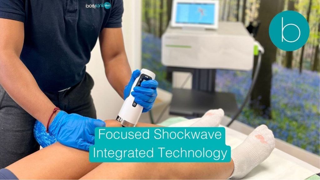 Focused Shockwave Therapy for chronic tendon pain at Bodytonic Clinic London.