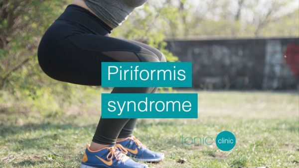 piriformis syndrome