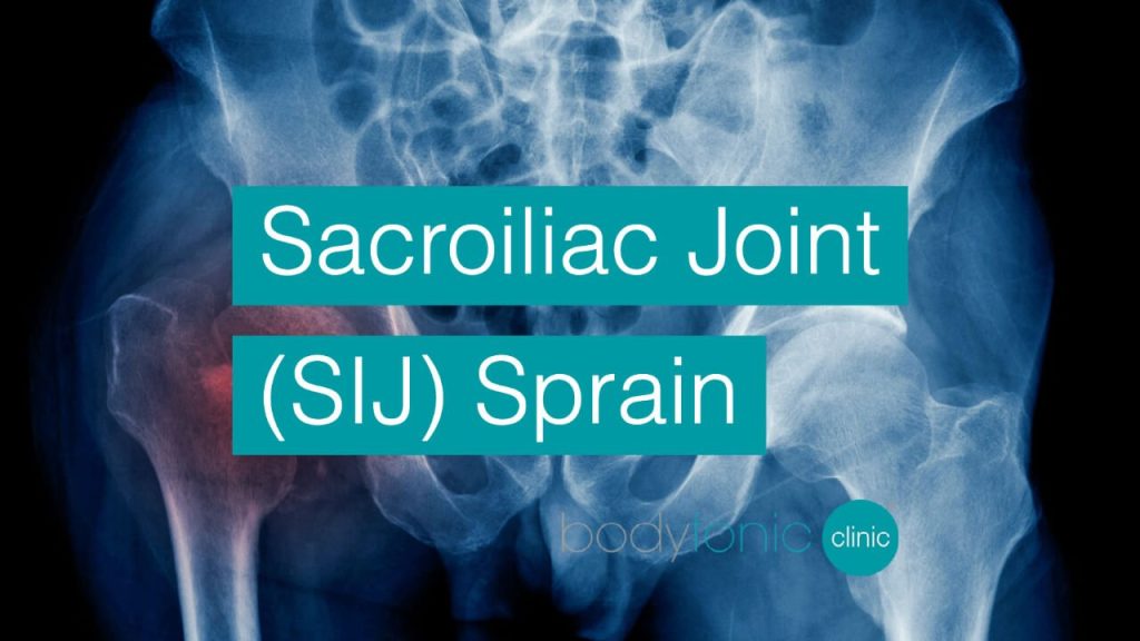 Sacroiliac Joint (SIJ) Sprain bodytonic clinic SE16 E15 E14 London