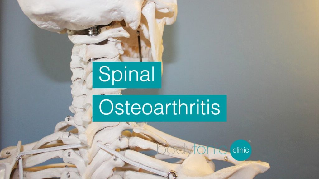 Spinal Osteoarthritis bodytonic clinic SE16