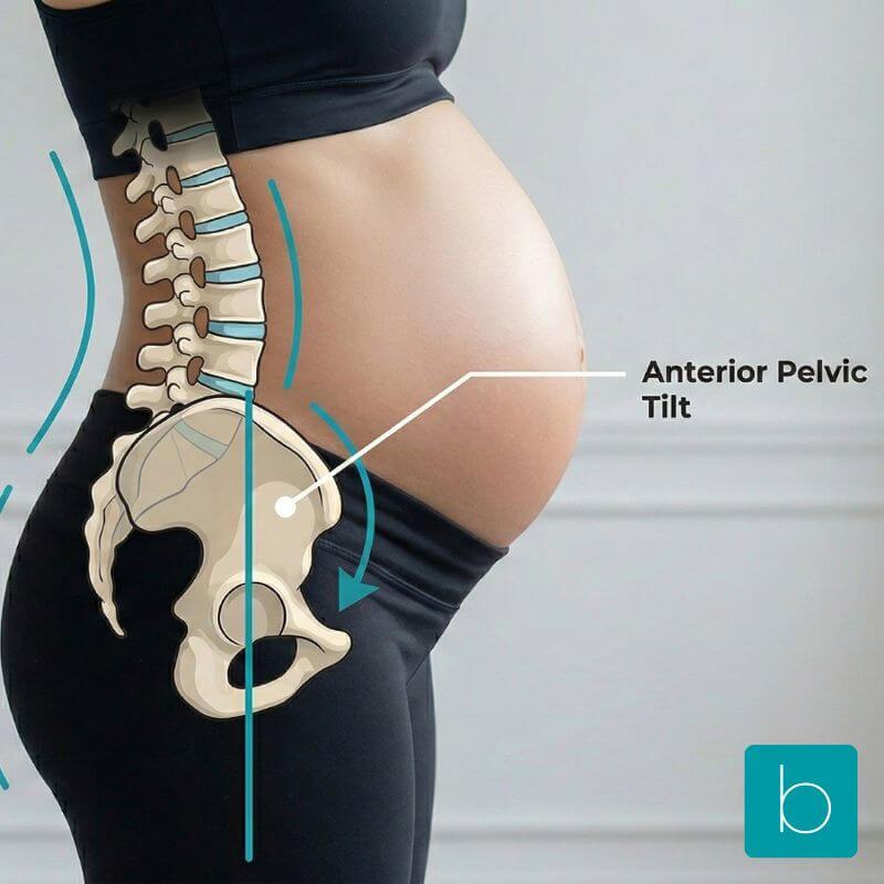 Diagram showing anterior pelvic tilt in pregnancy, illustrating the shift in center of gravity and increased pressure on the lumbar spine.