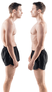 bad-posture-bodytonic-clinic-1-171x300