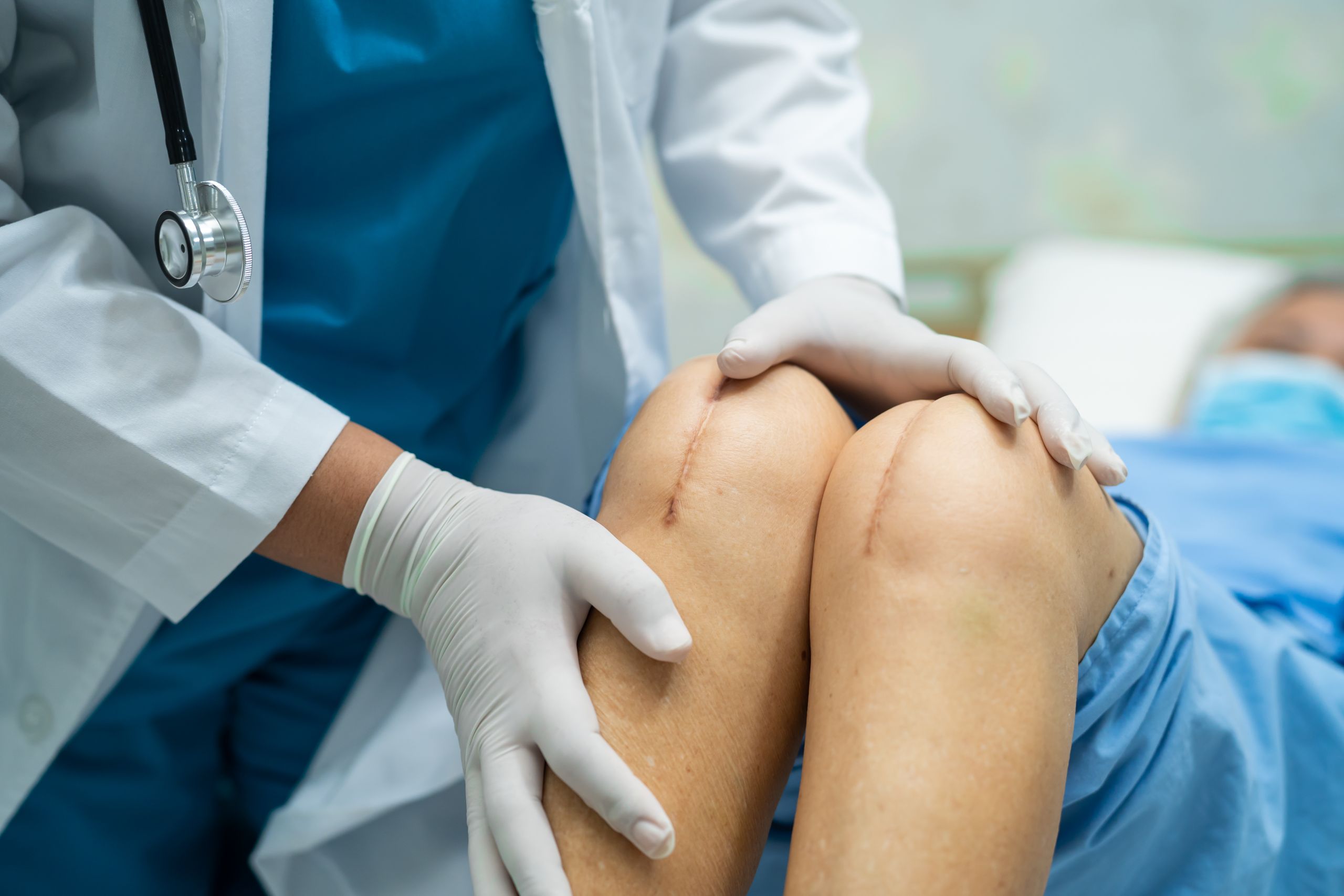 A healthcare professional in medical scrubs and gloves examines the knees of a patient lying in a hospital bed, with visible surgical scars indicating recent knee surgery.