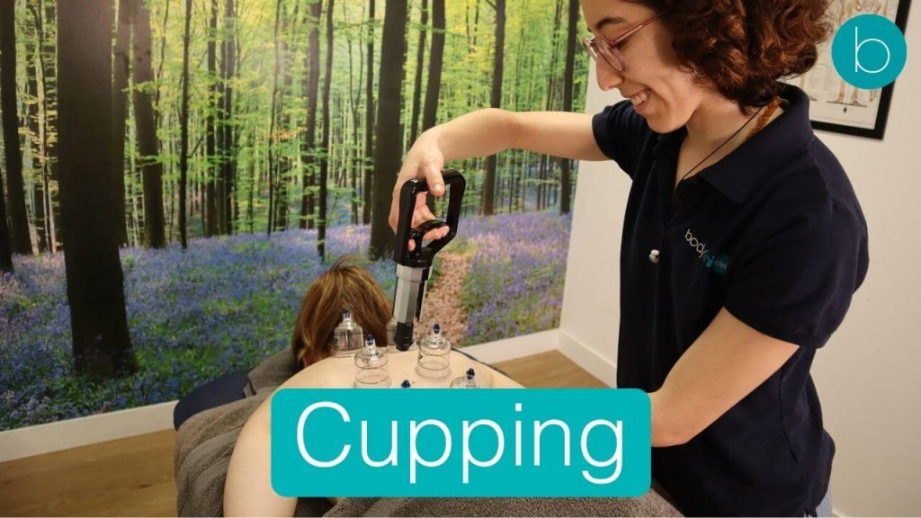 Best Cupping-Deep-Tissue-Massage-London-bodytonic-clinic-E15-SE16