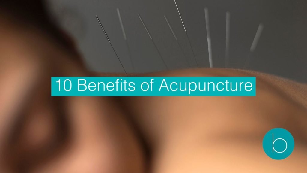 benefits of acupuncture