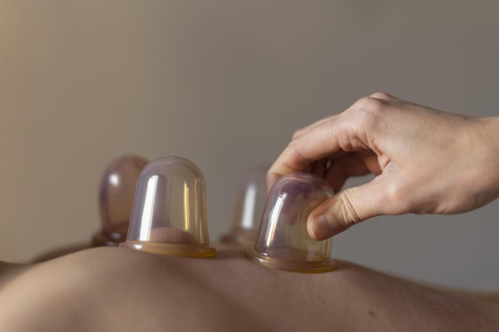 silicone cupping