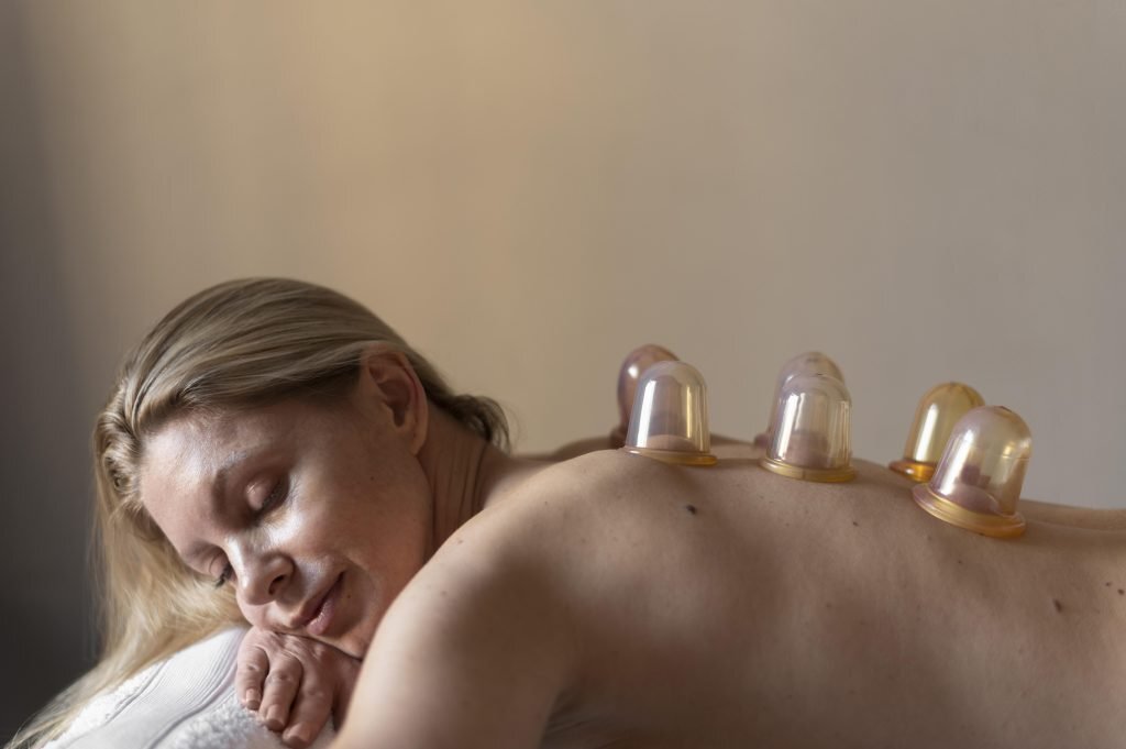 Woman lying on her side with cupping therapy cups placed along her upper back.