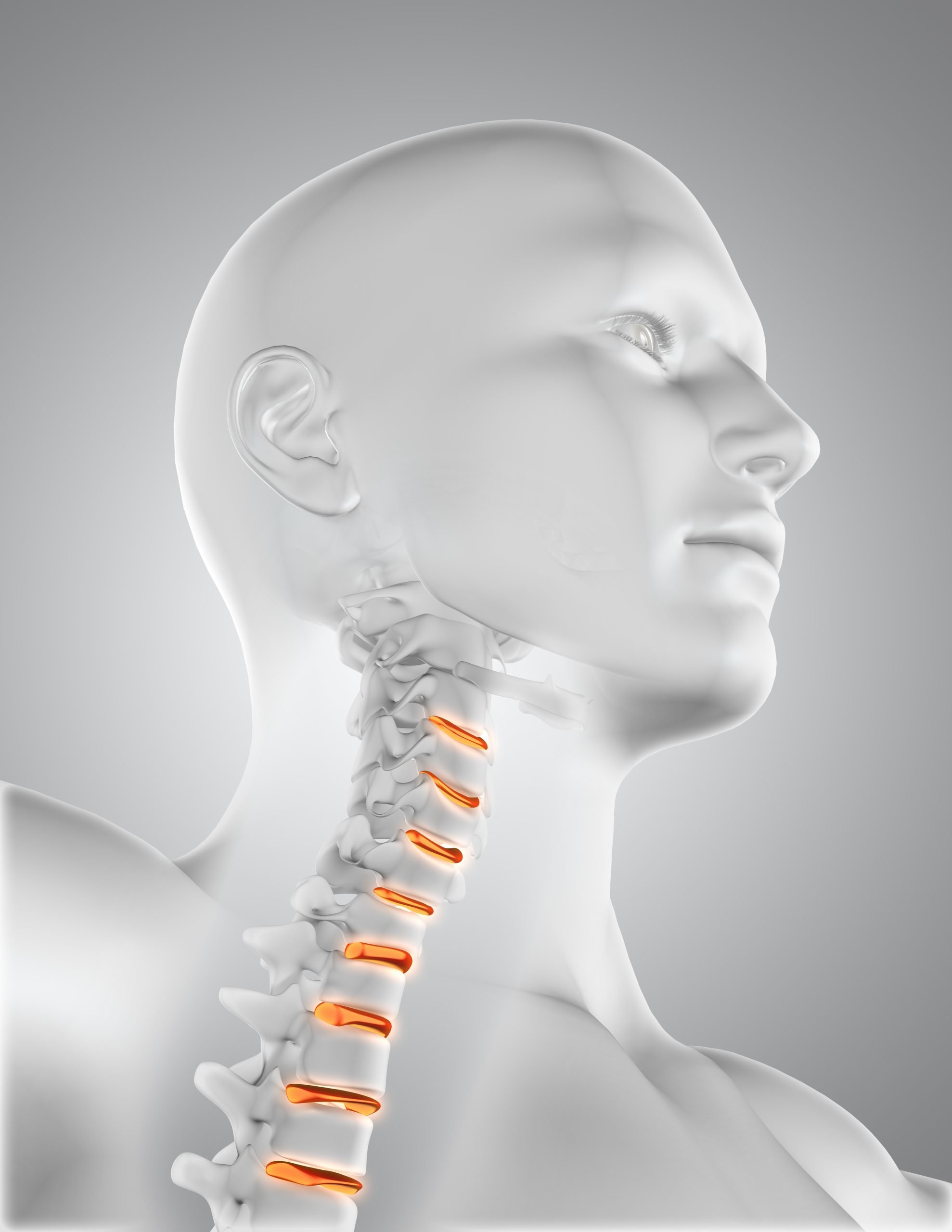 3d cervical area scaled Cervical Facet Pain