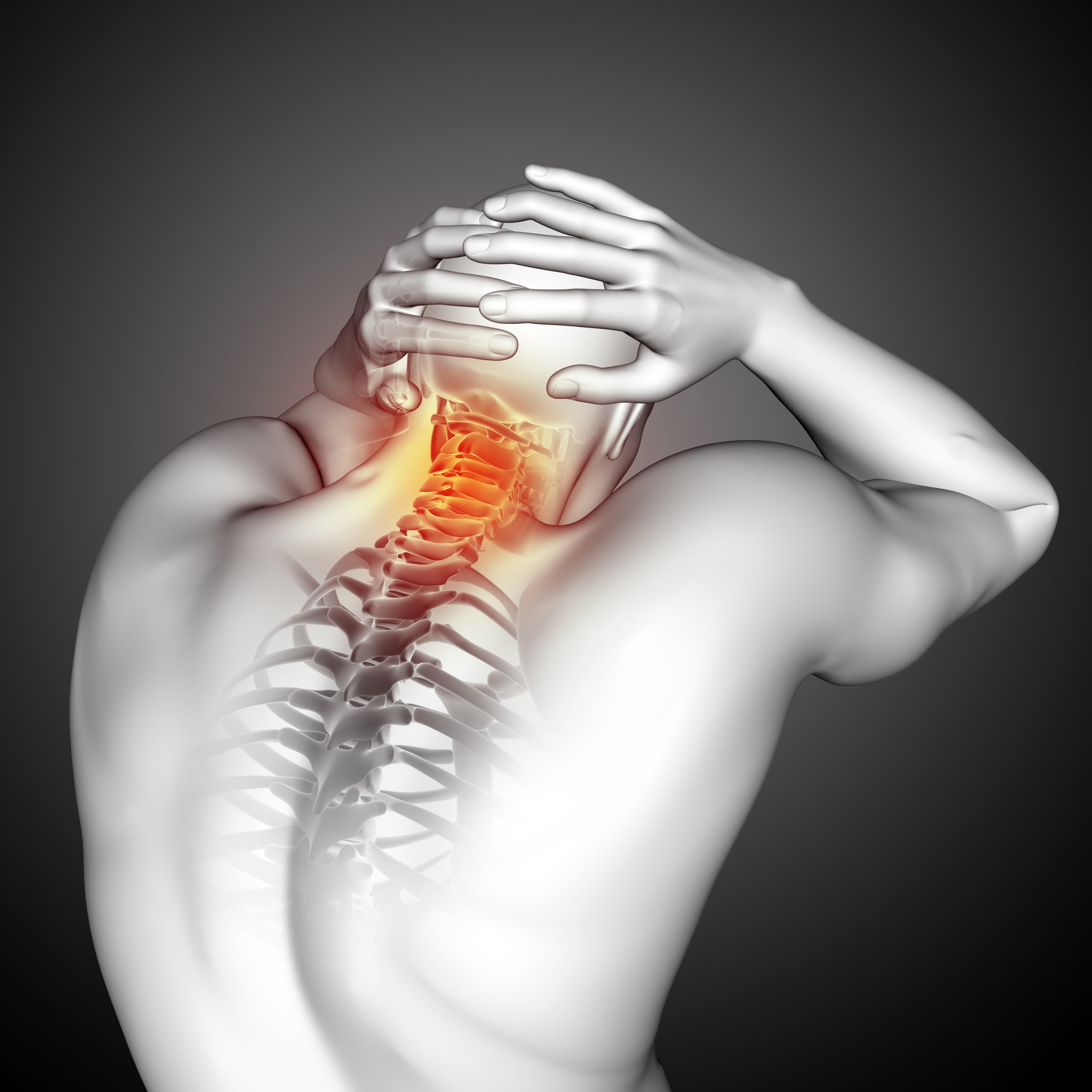 3d render male medical figure with top spine highlighted scaled Cervical Facet Pain