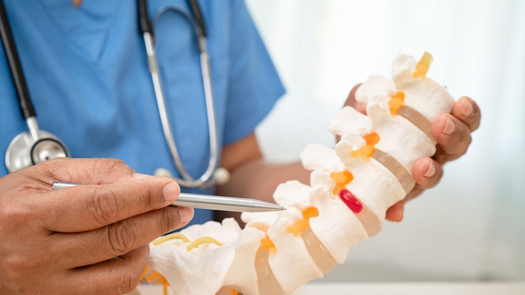 A doctor holding a 3D model of a human spine, pointing at a bulging disc with a pen.