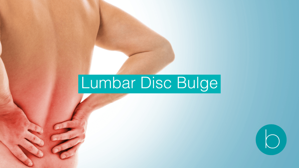 lumbar disc bulge image