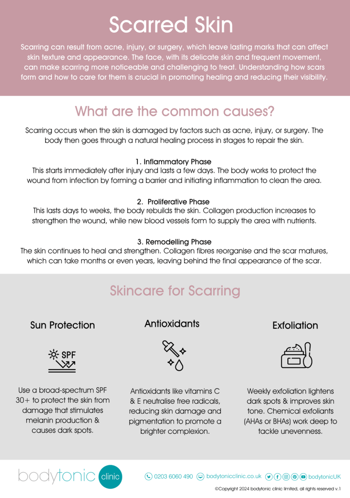 Environ and Advanced Nutrition Scarring Infographic Page 1