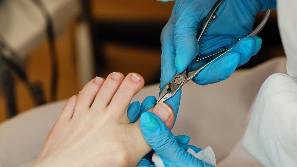 Close-up of a medical practitioner using nail nippers to treat a patient's toenail while wearing blue gloves.