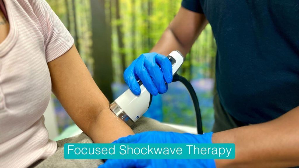 Focused Shockwave Therapy fSWT London SE16 E14 E15 E20 SE1