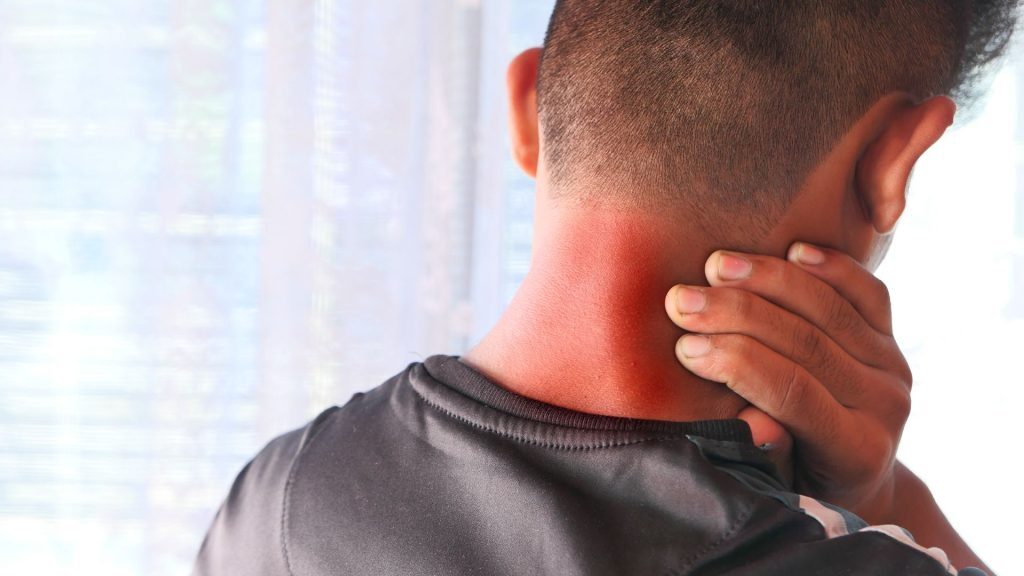 Man holding the back of his red, irritated neck in discomfort.