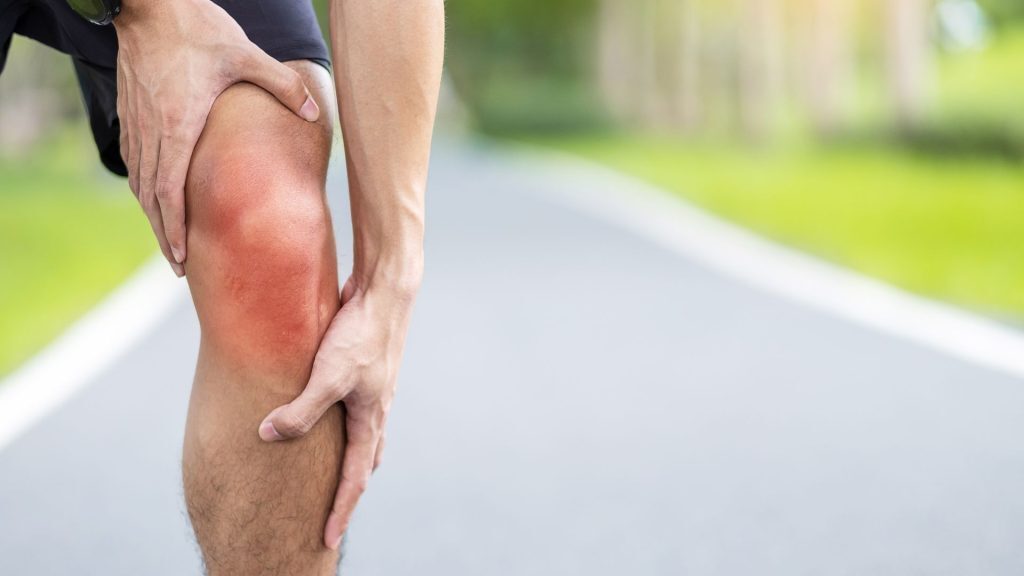 Person holding their red, inflamed knee while standing on a road.