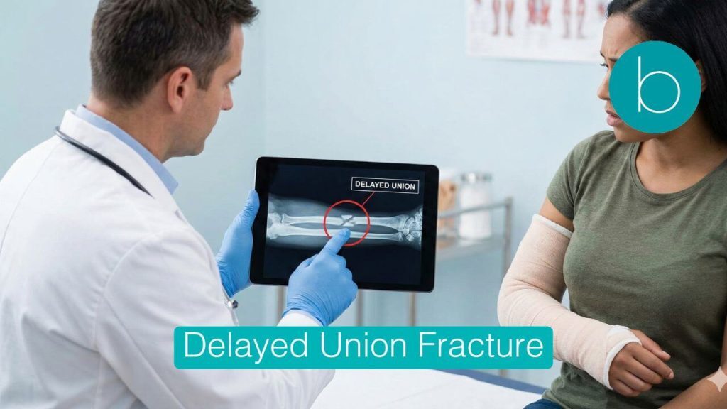 A doctor explains a "Delayed Union" forearm fracture diagnosis to a concerned patient in an arm cast, using a digital X-ray displayed on a tablet.