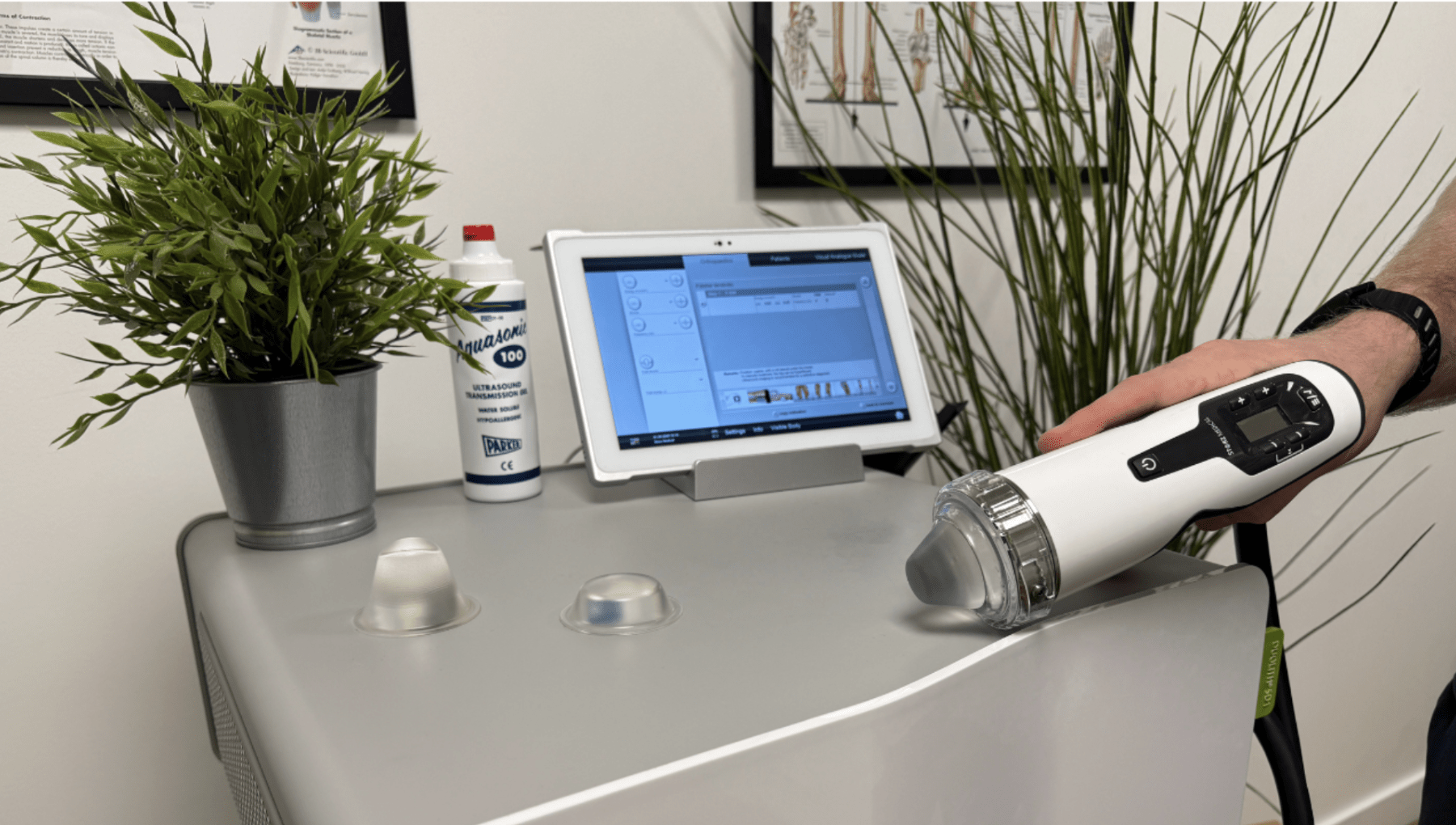 Patient receiving focused shockwave therapy at Bodytonic Clinic in London, Canada Water SE16 and Stratford E15 E20 
